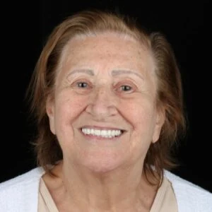 Paciente Oral Sin Barra Bonita sorrindo após tratamento