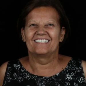 Paciente Oral Sin Barra Bonita sorrindo após tratamento